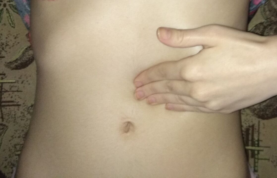 Zdravý žalúdok po liečbe kapsulami NEOflorax