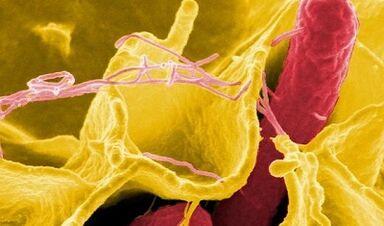 Známky parazitov v ľudskom tele