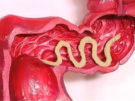 paraziti v ľudskom tele, prečo sa objavujú