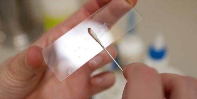 Škrabanie kože na parazity