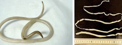 druhy parazitov v ľudskom tele