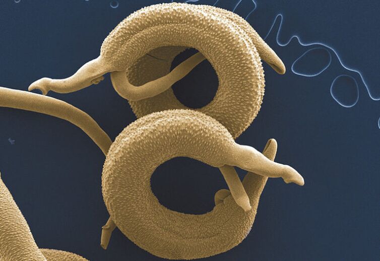 parazity žijúce v ľudskom tele